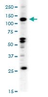 PAB3020 - EPHB2