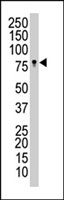 PAB3021 - EPHB3