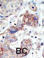 PAB3021 - EPHB3
