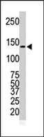 PAB3034 - CD340 / ERBB2 / HER2