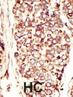 PAB3034 - CD340 / ERBB2 / HER2