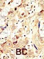 PAB3038 - ERBB4 / HER4
