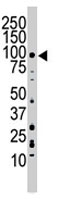 PAB3043 - CD333 / FGFR3