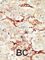 PAB3043 - CD333 / FGFR3