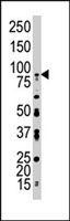 PAB3044 - CD334 / FGFR4