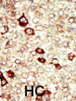 PAB3044 - CD334 / FGFR4