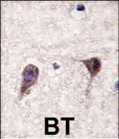 PAB3053 - HS2ST1 / 2OST
