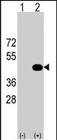 PAB3053 - HS2ST1 / 2OST