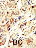 PAB3055 - CD221 / IGF1R
