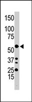 PAB3057 - Integrin-linked protein kinase