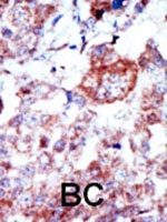 PAB3057 - Integrin-linked protein kinase