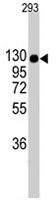 PAB3065 - Collagen type II alpha 1 chain