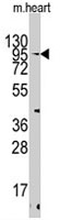 PAB3069 - TRPV3