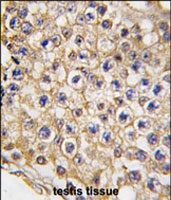 PAB3069 - TRPV3