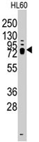 PAB3070 - TRPV3 (Heat sensitive channel)
