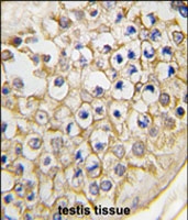 PAB3070 - TRPV3 (Heat sensitive channel)