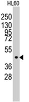 PAB3071 - LMX1A