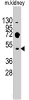 PAB3072 - EVX2