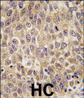 PAB3074 - Alpha-fetoprotein / AFP