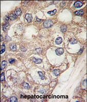 PAB3075 - Alpha-fetoprotein / AFP