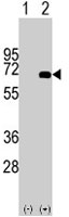 PAB3075 - Alpha-fetoprotein / AFP