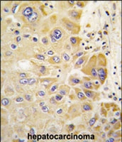 PAB3078 - ALDH3