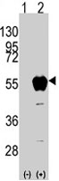 PAB3078 - ALDH3