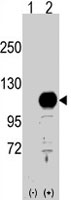 PAB3085 - BCAS3 / GAOB1