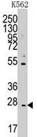 PAB3088 - CD8 beta