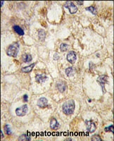 PAB3091 - SSR1 / TRAPA