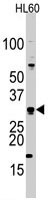 PAB3096 - CDCA8 / Borealin