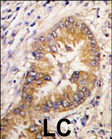 PAB3096 - CDCA8 / Borealin