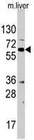 PAB3097 - STK39 / SPAK