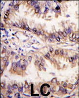 PAB3097 - STK39 / SPAK