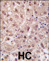 PAB3099 - PSMA5