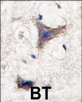 PAB3100 - SPRED1
