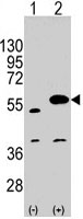 PAB3100 - SPRED1