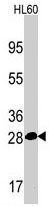 PAB3101 - PSMA5