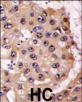 PAB3101 - PSMA5