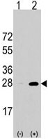 PAB3101 - PSMA5