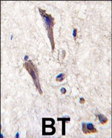 PAB3102 - SPRED1
