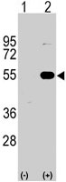 PAB3102 - SPRED1