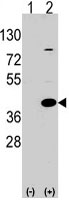 PAB3106 - Laforin