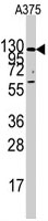 PAB3109 - Insulin-degrading enzyme