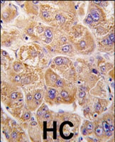 PAB3109 - Insulin-degrading enzyme