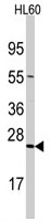 PAB3111 - TRAPPC4