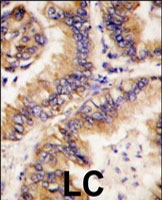 PAB3111 - TRAPPC4