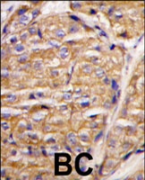 PAB3114 - MIPEP
