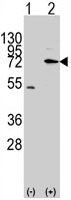 PAB3114 - MIPEP