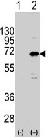 PAB3119 - CNOT4